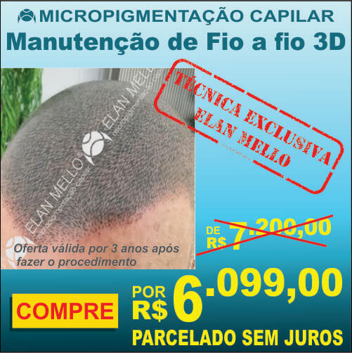 Manutenção ou Retoque de Fio a fio 3D
