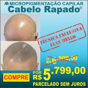 Micropigmentação Capilar "Cabelo Rapado®"