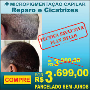 Micropigmentação Capilar "Reparo de Cicatriz"