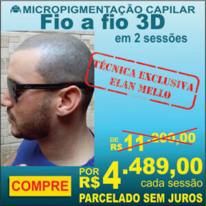Micropigmentação Capilar "Fio a fio 3D"