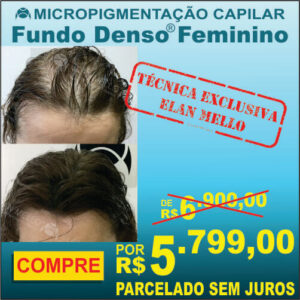 Micropigmentação Capilar "Fundo Denso®" Feminino