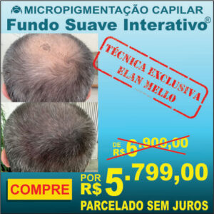 Micropigmentação Capilar "Fundo Suave Interativo®"