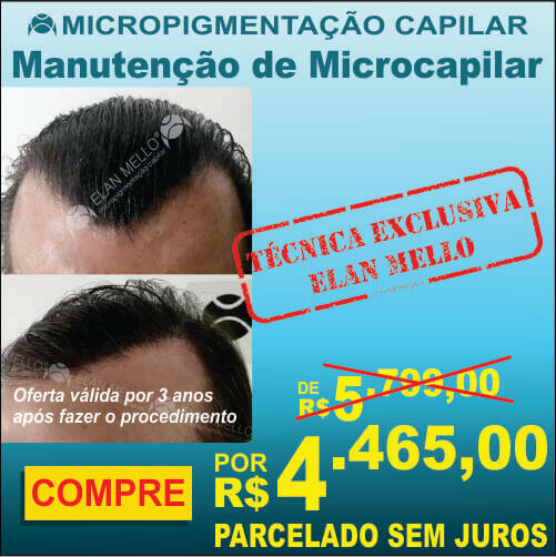 Manutenção de Micropigmentação Capilar