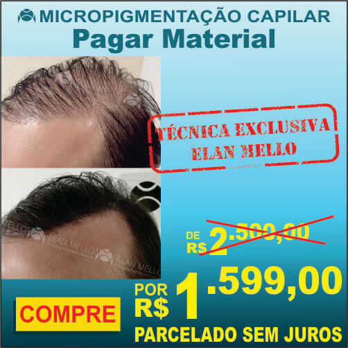 Material Usado na Micropigmentação Capilar