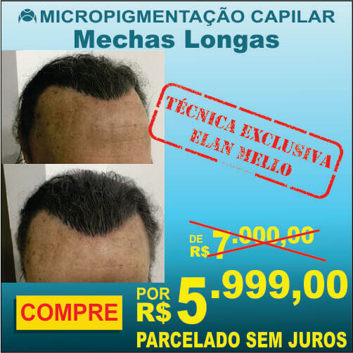 Micropigmentação Capilar "Mechas Longas"