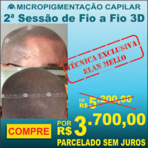 Complemento (2ª sessão)* para Fio a fio 3D