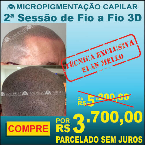 Complemento (2ª sessão)* para Fio a fio 3D