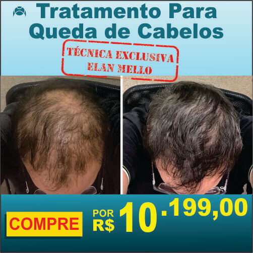 Tratamento para queda de cabelos