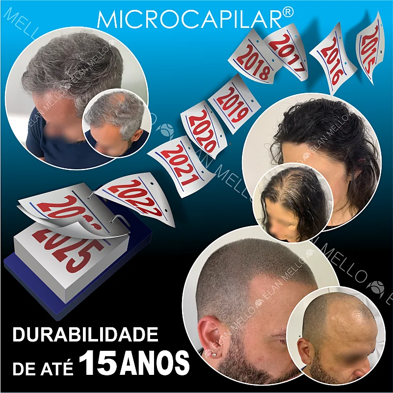 Durabilidade da Microcapilar®